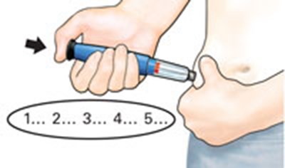 Figure - forteo um f11 v1