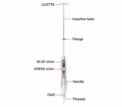 Figure 2:  Inserter Sliders (Liletta Shi 03)