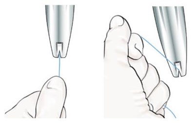 Figure 6: Adjusting The Flange (Liletta Shi 07)