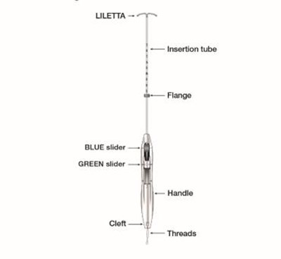 Liletta Is Small And Flexible. (Liletta Shi 13)
