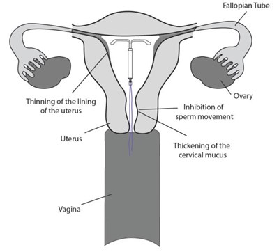 liletta-shi-16.jpg PRINCIPAL DISPLAY PANELNDC 0023-5858-01Rx onlyLiletta® (levonorgestrel-releasing intrauterine system) 52 mg - liletta shi 16
