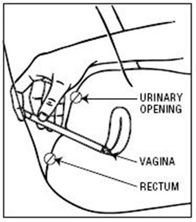Image (Terconazole 05)