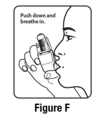 Figure F (Ifu F)