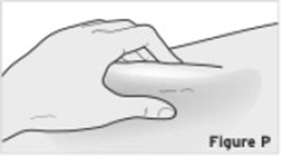 Figure (Tye01 0000 54)