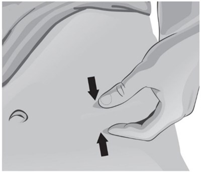 Figure Z (Arcalyst 03z)