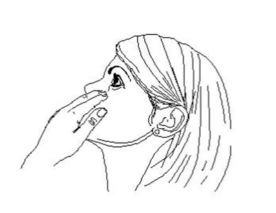 5. To Open The Bottle, Unscrew The Cap By Turning As Indicated. (Dorzolamide HCl And Timolol 7)