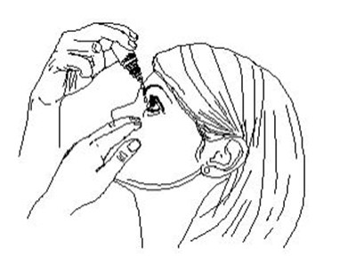 6. Tilt Your Head Back And Pull Your Lower Eyelid Down Slightly To Form A Pocket Between Your Eyelid And Your Eye. (Dorzolamide HCl And Timolol 8)