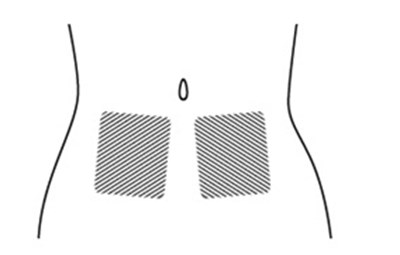 Icatibant-fig-f (Icatibant Fig F)