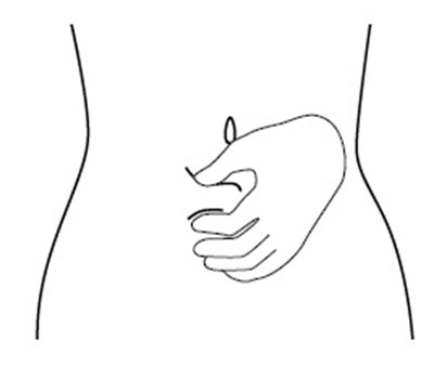 Icatibant-fig-j (Icatibant Fig J)