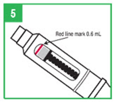 Step 5 (Image 15)