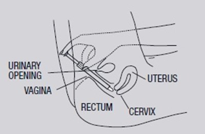 Step-4 (Image 02)