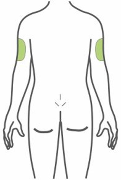 Figure (Trulicity Ifu 4point5mg Injection Sites Back V1)