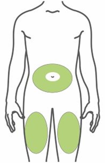 Figure (Trulicity Ifu 4point5mg Injection Sites Front V1)