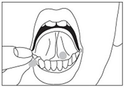 Place Tablets Under Tongue (Image 01)