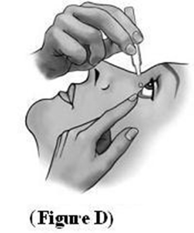Dorzolamide-timolol-figd.jpg (Dorzolamide Timolol Figd)