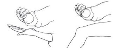 Figure A - diclofenac 02