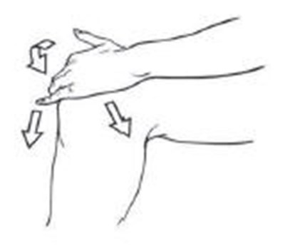 Figure B - diclofenac 03