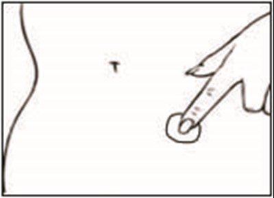 2 (Dotti Estradiol Transdermal System 8)