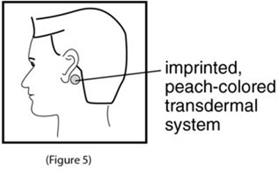 Instructions For Use Figure 5 (Image 08)