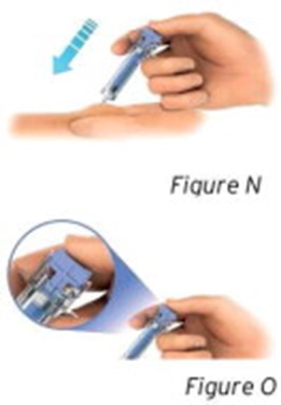 Figures N and O - sti04 0001 14