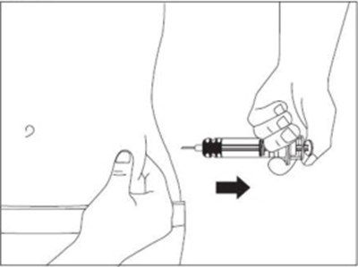 Figure - eno0j 0000 22