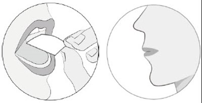 Figure E (Opipza 13)