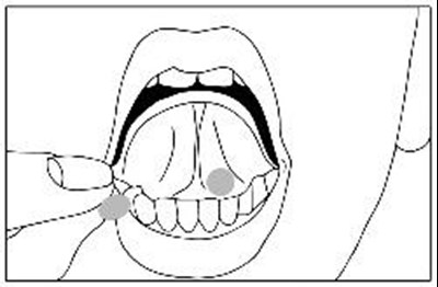 Mouth Illustration (Buprenorphine HCl Sublingual Tabs 2)