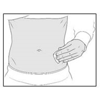 Figure F (Enox Ifu F)