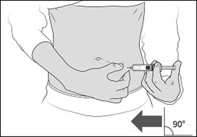 Figure J (Enox Ifu J)