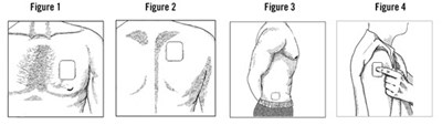 Applying A Fentanyl Transdermal System Figure 1-4 (1d03fd3c Ae7c 4605 92eb 263f9e78ad9e 05)