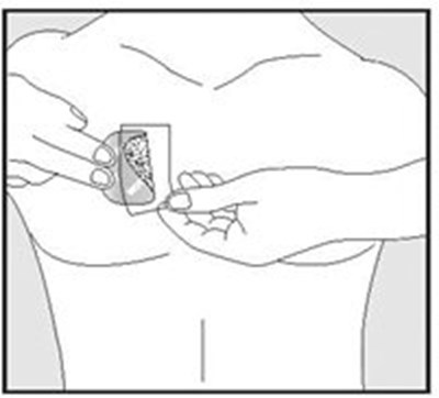 Instructions For Use Figure G (Image 15)