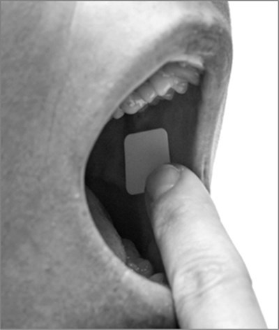 Figure E - belbuca 08