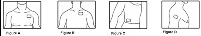Figure A To D (Figure A D)