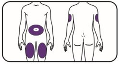 Figure (Mounjaro Kp 15 Inj Sites V1)
