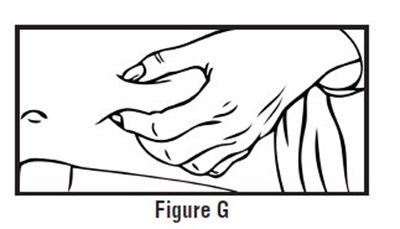 Figureg1.jpg (Figureg1)