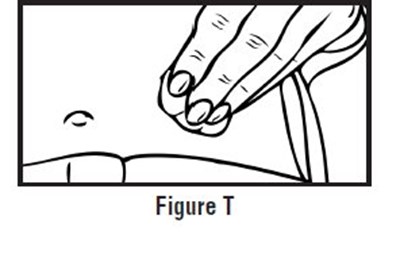 Figuret3.jpg (Figuret3)