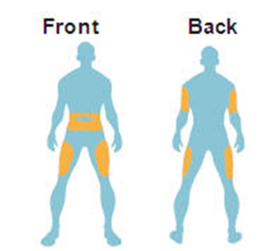 Figure (Byetta 40)