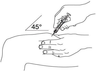 Figure F (Stelara 10)