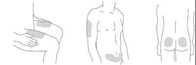 Figure B (Stelara 14)