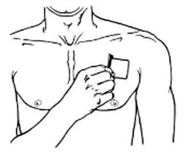 Figure G - buprenorphine transdermal system 12