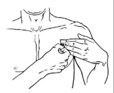 Figure H - buprenorphine transdermal system 13