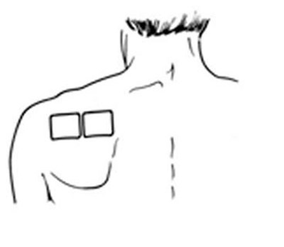 Figure B - buprenorphine transdermal system 7