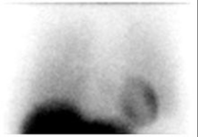 Figure 1 (Adreview 01)
