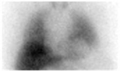 Figure 2a (Adreview 02)