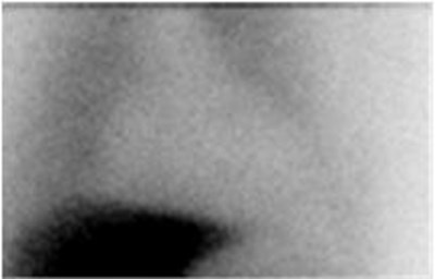 Figure 2b (Adreview 03)