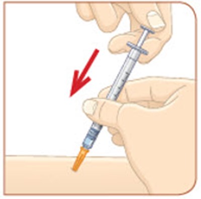 Figure - metreleptin 73