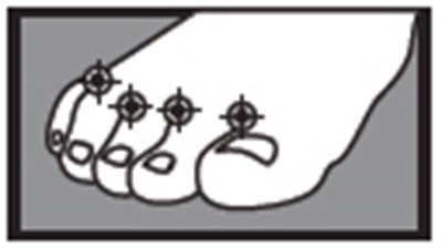 Figure - terbinafine 01