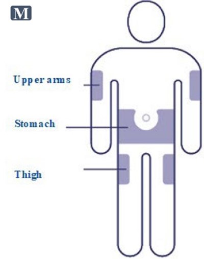 Fig. M (Image 12)