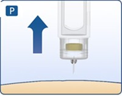 Fig. P (Image 15)