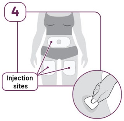 Image Of Choosing Injection Site (AI instructions for use)